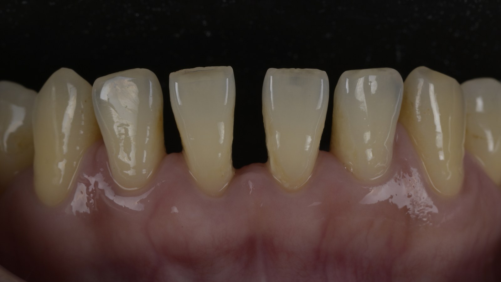 治療前