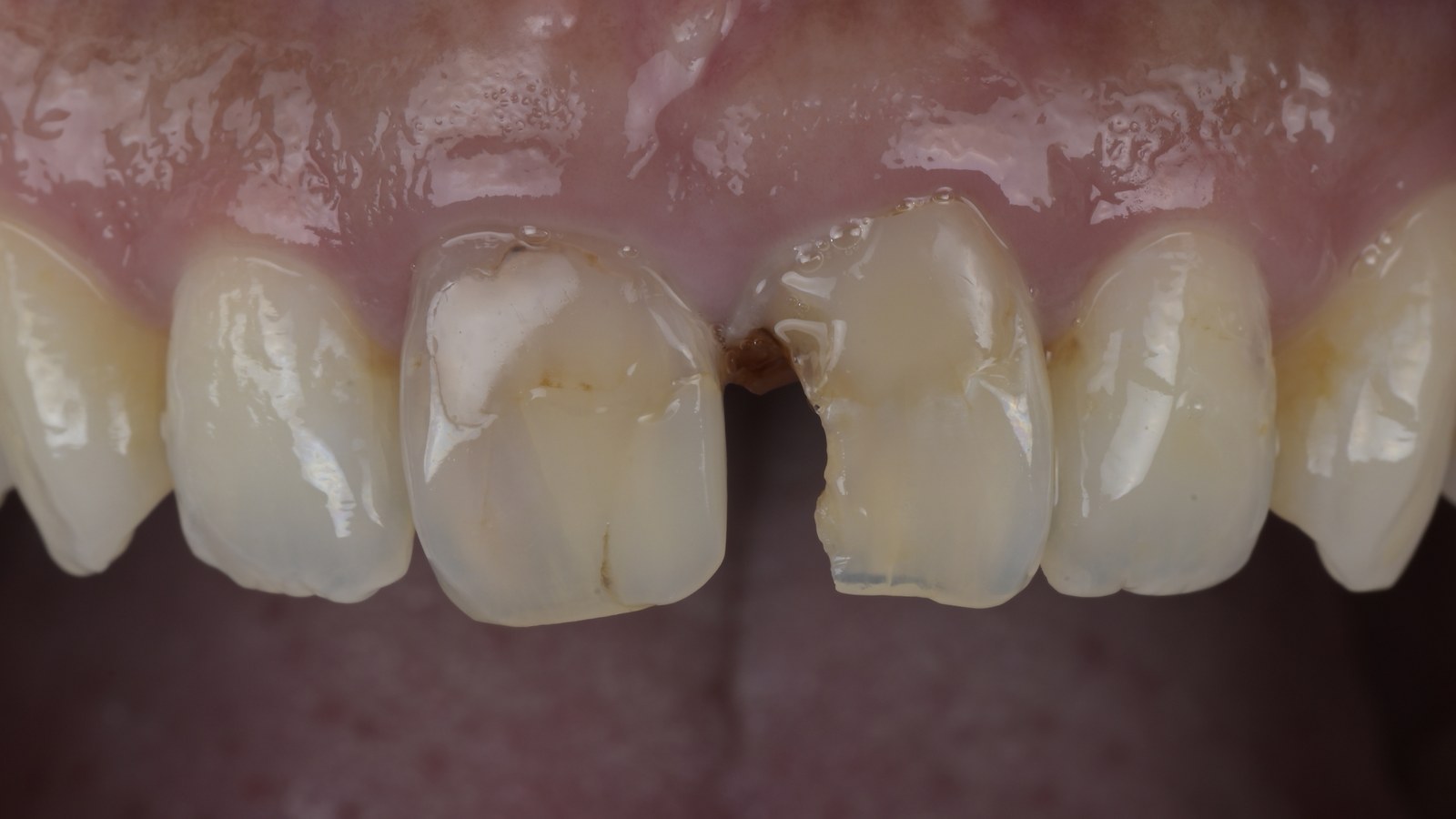治療前