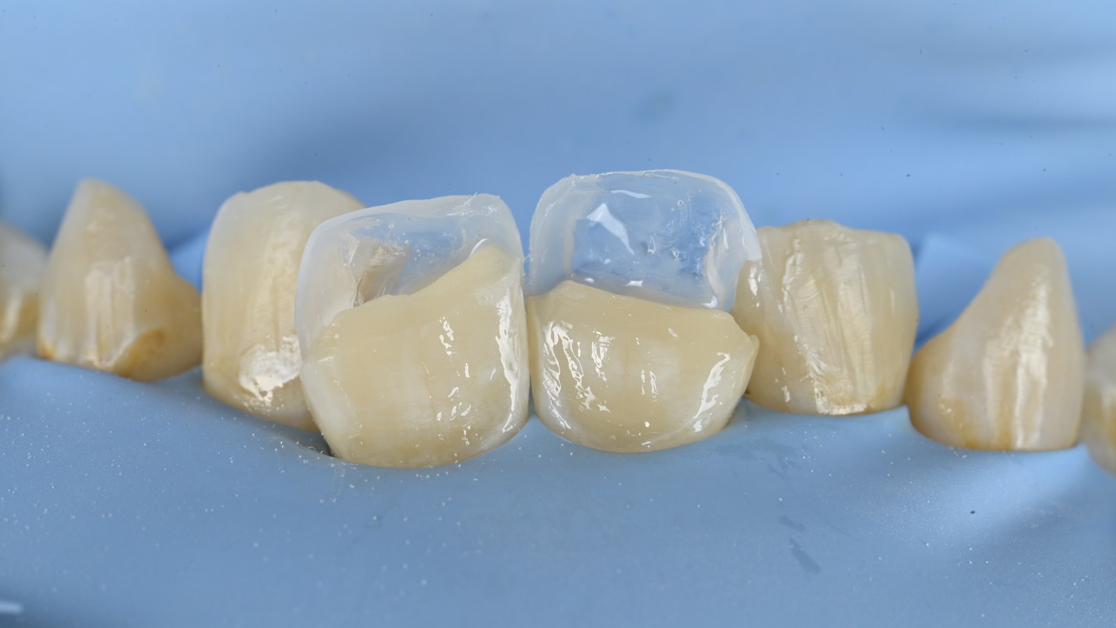 階段三・palatal shell 建立背側殼